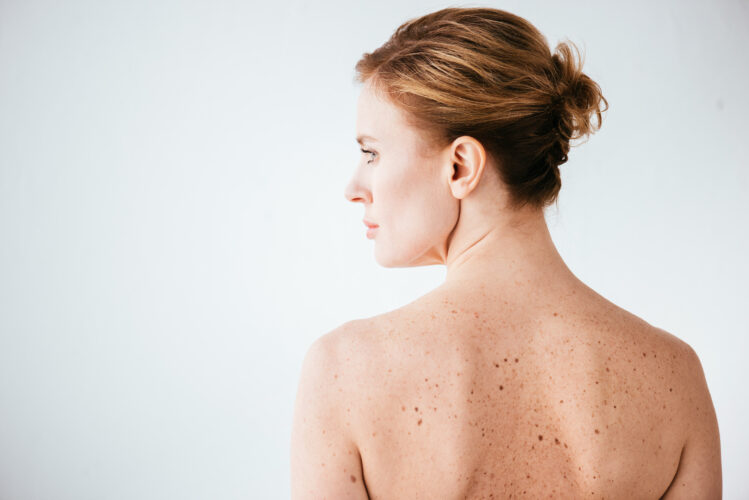 Hautkrebsprävention & UV-Schutz