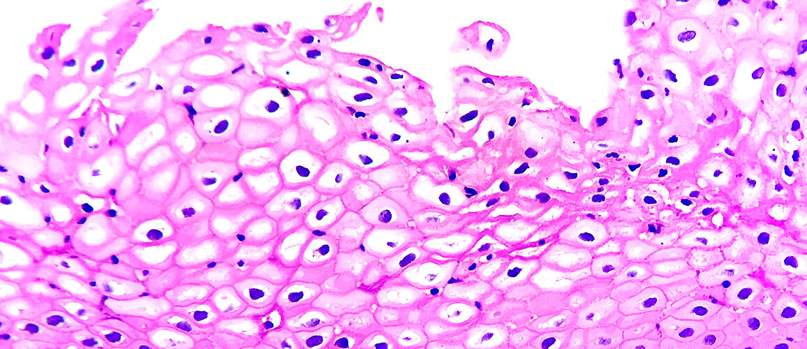 Examen des applications radiothérapeutiques en dermatologie 2026